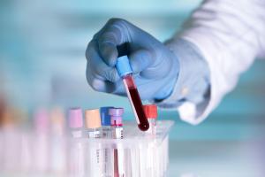 Be vigilant! Five symptoms mean your blood glucose is too high