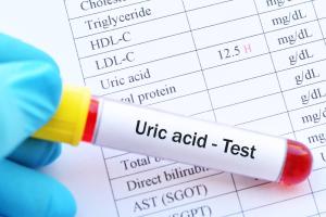 Know Adout High Uric Acid Level