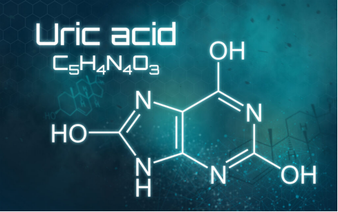 When and why should we have a uric acid test