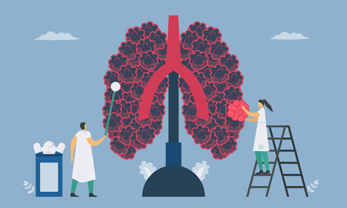 COPD: When Breathing Becomes a Struggle