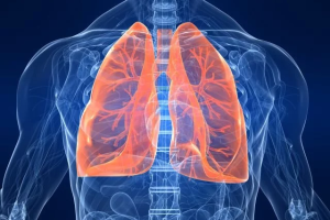 Pneumoconiosis: What You Need to Know About “Dust Lung”